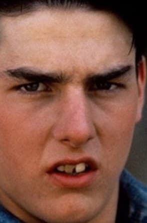 Antes do caso Recuperação funcional e estética com próteses personalizadas